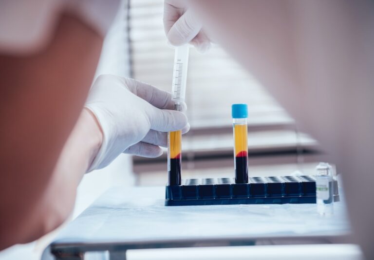 Engineered platelets can induce anti-inflammatory, immunosuppressive response, finds St. Michael’s researcher